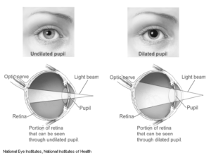 Illustration of dilated and undilated eye from National Eye Institutes, National Institutes of Health