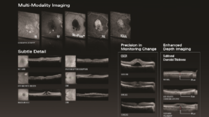 OCT detailed imaging of the retina