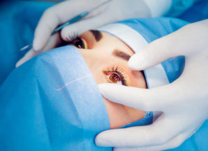 vitrectomy, scleral buckle, laser, cryopexy, dislocated IOL, cataract complications, eye trauma surgery
